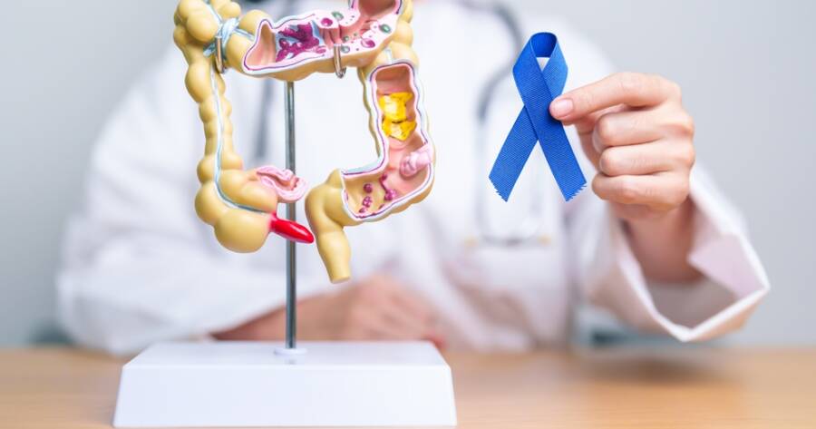 Early Symptoms and Treatments for Colon Cancer
